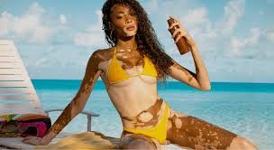 Winnie Harlow Official Store: Model Redefines Beauty