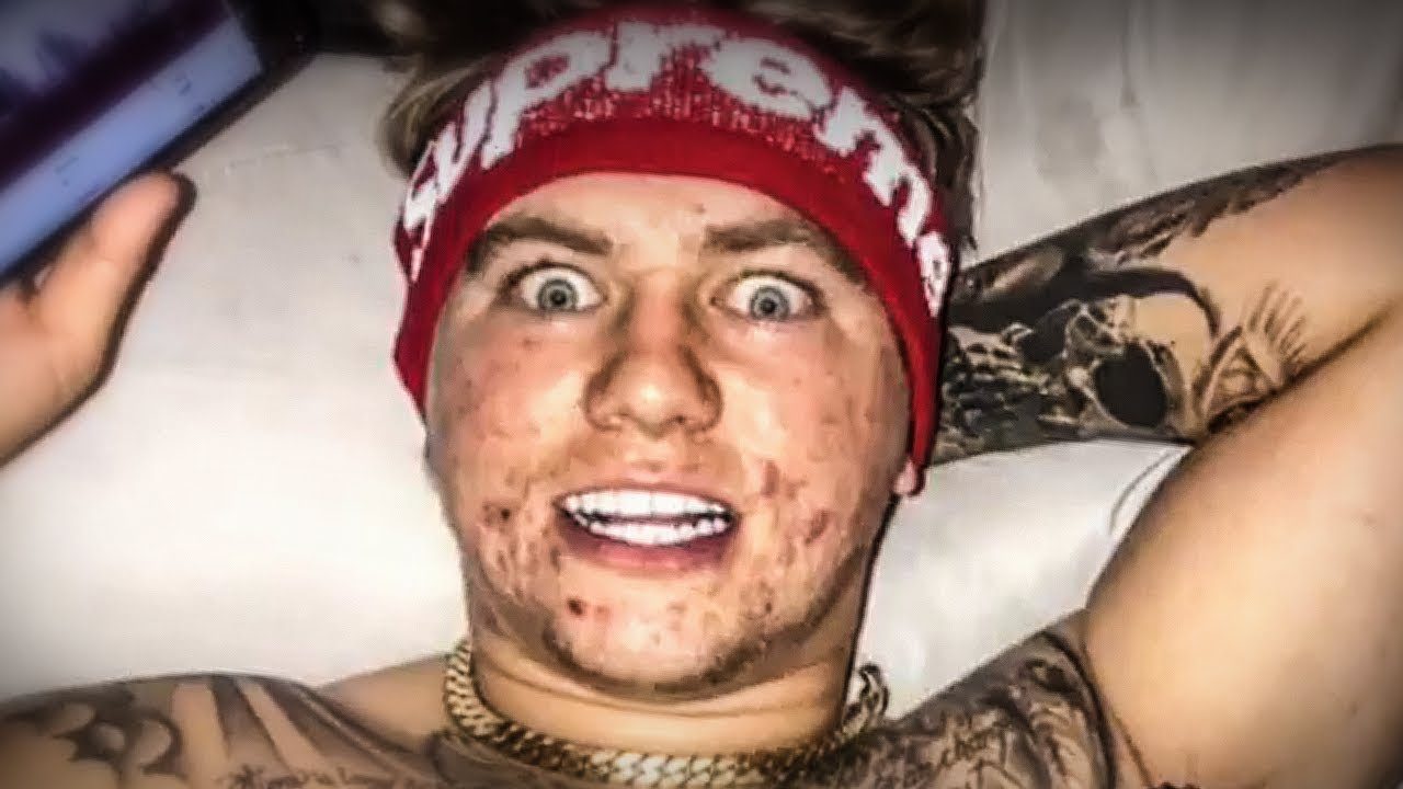 Supreme Patty Merch Boxer: 5 Designs That Pack a Punch