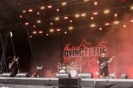 Dying Fetus Official Merchandise: 5 Items Fans Crave