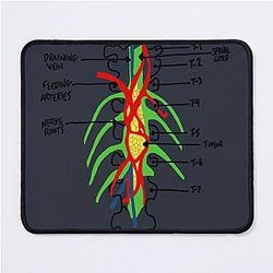 Grey's Anatomy Tumor Mousepad