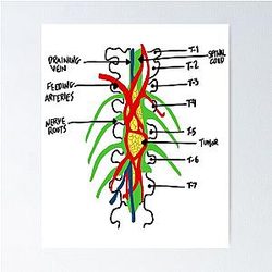 Grey's Anatomy Tumor Poster