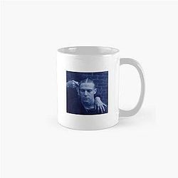 Malcolm Todd Chest Pain Classic Mug